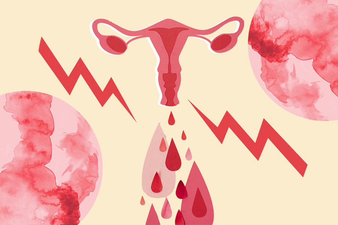 Period Pain: Why It Happens and How to Take Control of It, According to Ob-Gyns
